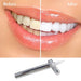 Flawless Teeth Whitening | UzoShop